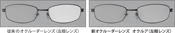 従来のオクルーダーとオクルアの比較